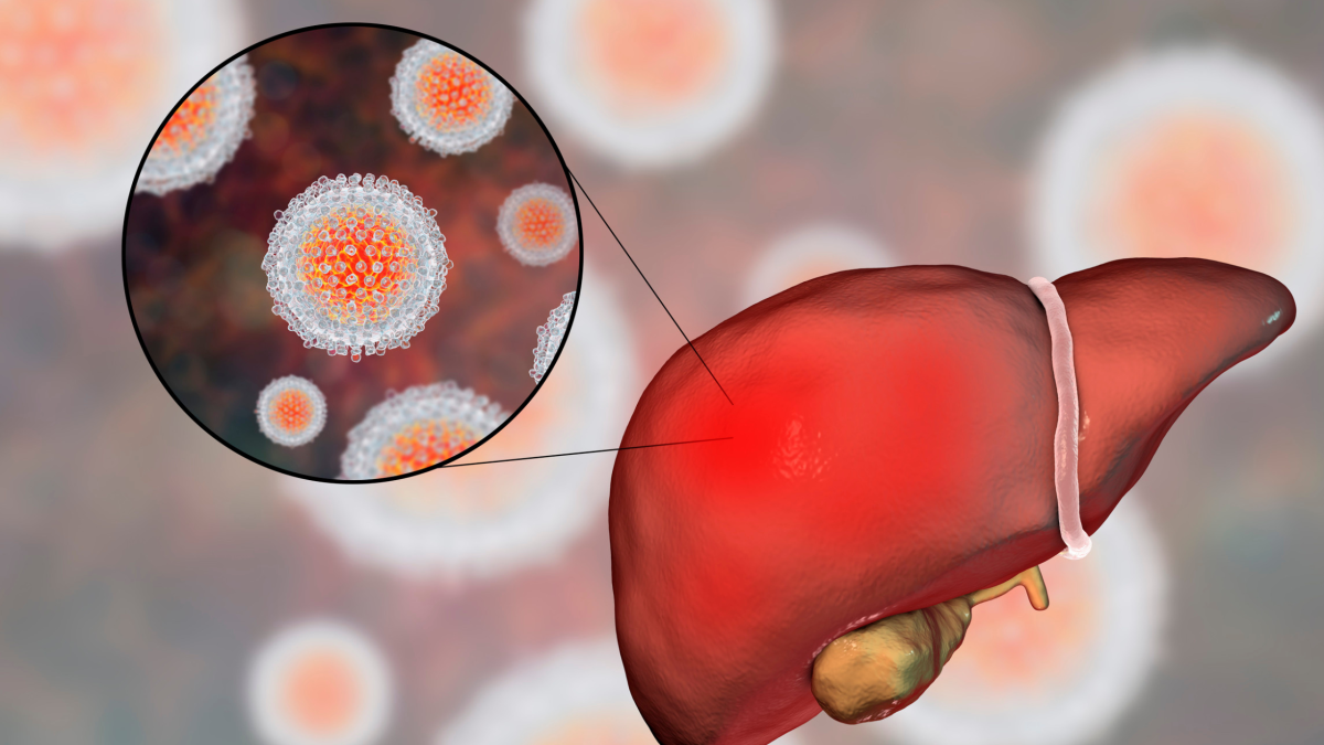 Untreated hepatitis can lead to serious long-term health issues. Learn about the risks and why early detection is key.